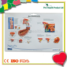 Prostate 3D Medical Wall Chart